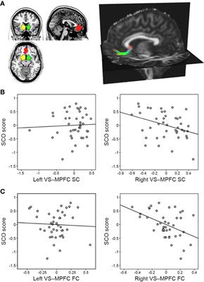 Intrinsic Functional and Structural Brain Connectivity in Humans Predicts Individual Social Comparison Orientation